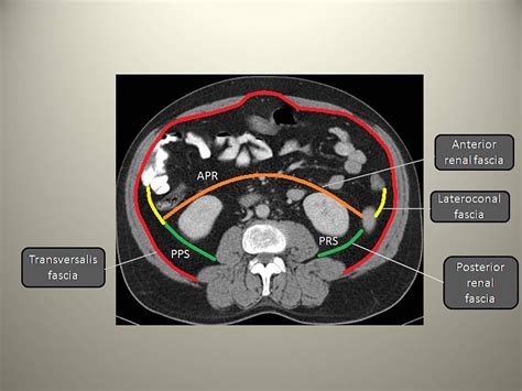 Ct Anatomy Of Renal Fascia at Oscar Godson blog