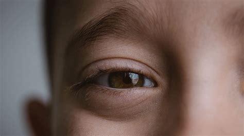 男孩右眼钻进寄生虫险失明！这病多见于儿童！ | 眼睛 | 寄生虫 | 玻璃体 | 视网膜 | 弓蛔虫病 | 粪-口传播 | 宠物 | 希望之声