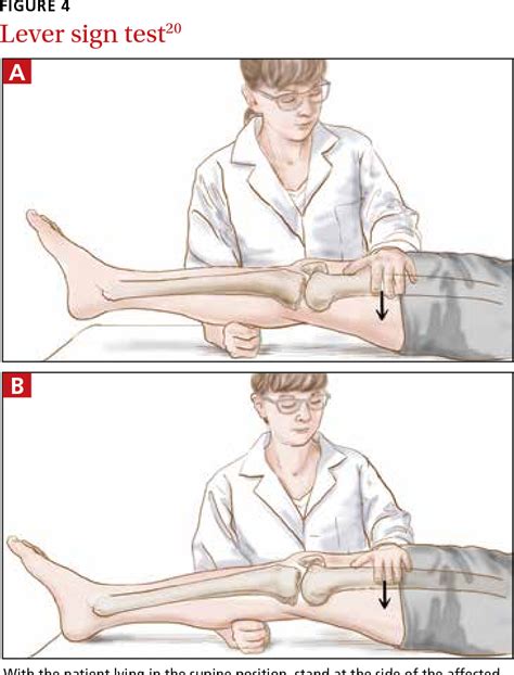 Image result for Lachman Testing