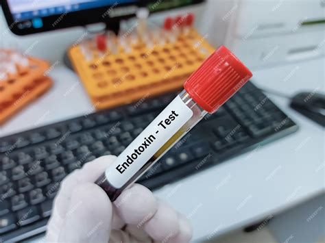 Premium Photo | Scientist holds blood sample for endotoxin test ...