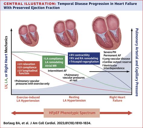 Heart Failure With Preserved Ejection Fraction: JACC Scientific ...
