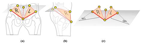 Impact of Quadriceps/Hamstrings Torque Ratio on Three-Dimensional ...