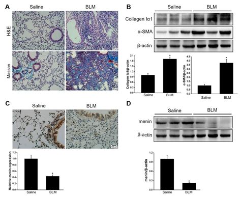 Dichotomous Roles of Men1 in Macrophages and Fibroblasts in Bleomycin ...