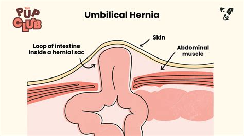 Umbilical Hernia In Dogs Septic Peritonitis: Incarcerated Bowel In