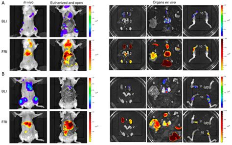 In Vivo Imaging of Prostate Cancer Tumors and Metastasis Using Non ...