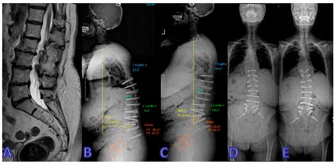 Dynamic vs. Rigid: Transforming the Treatment Landscape for ...