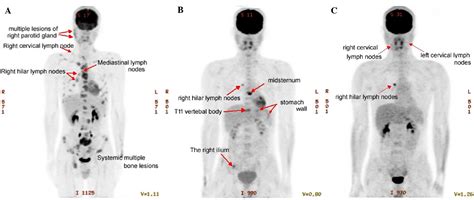 Image result for Real-Time Example for Pattern