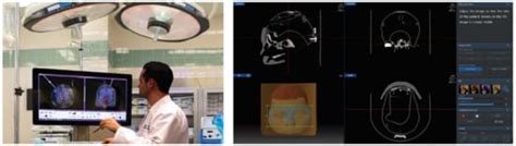 Optimal Usability Test Procedure Generation for Medical Devices