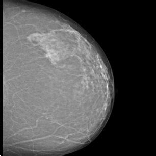 Intensity Range 的图像结果