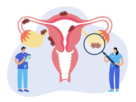 Chocolate Cyst Ovary What Are Endometriosis & Endometrioma? – Chua