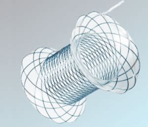 PALLIATOR PSEUDOCYST STENT – Endomed Technologies