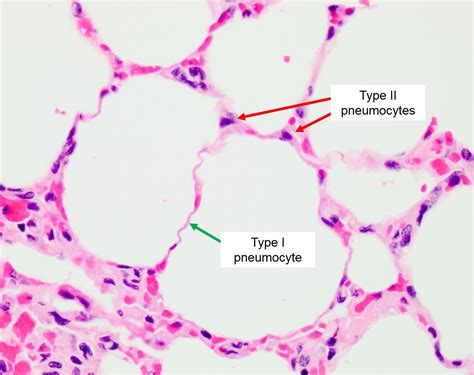 Function Of Simple Squamous Epithelium In Alveoli at Luke Earsman blog