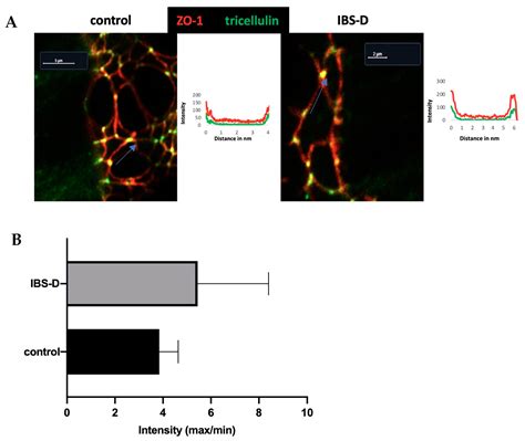 Epithelial Barrier Dysfunction in Diarrhea-Predominant Irritable Bowel ...