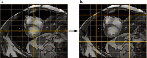 Image result for Partition by Window Function