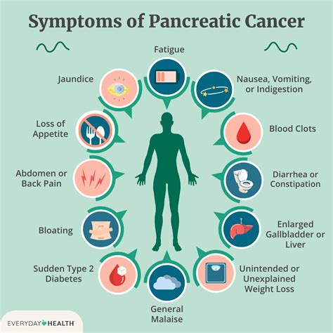 Understanding the Warning Signs of Pancreatic Cancer - 𝕋𝕖𝕔𝕙𝕟𝕖𝕨𝕤𝕚𝕟𝕗𝕠𝕠