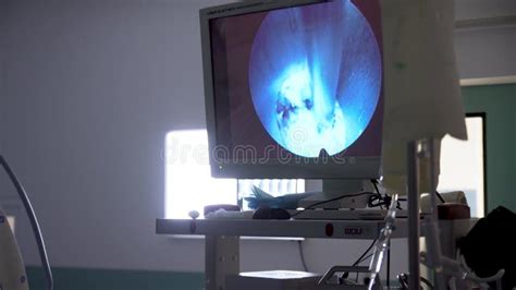 Operating Room Camera 的图像结果