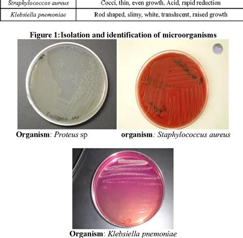 Image result for Urease