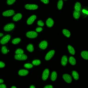 Image result for Ana Pattern Screen