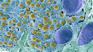 In a 1st, scientists reversed type 1 diabetes by reprogramming a person ...