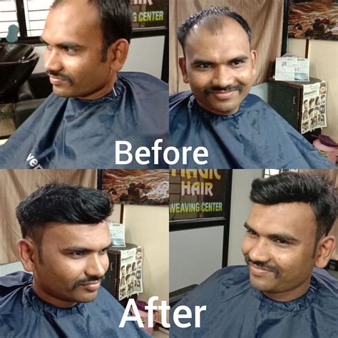 Magic Hair Weaving Centre | Nagpur, India