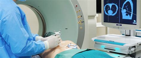 Image result for Interventional Procedure