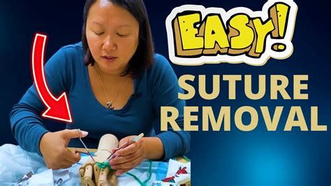Removing Sutures Step by Step 的图像结果