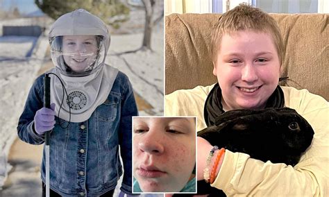 Woman won't leave her house without a $1,300 face shield