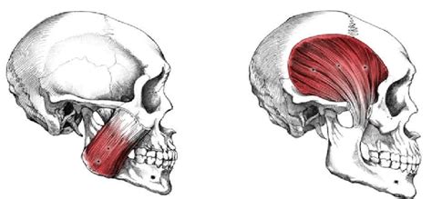 Image result for Masseter Muscle Trigger Point