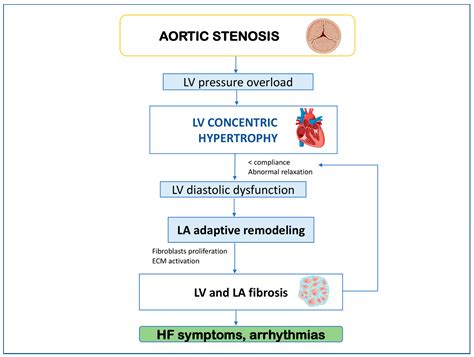 Mitral Valve Stenosis Pathophysiology