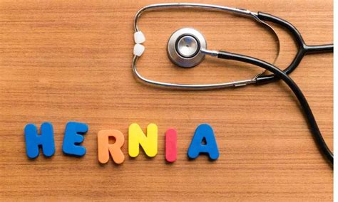 Geriatric nutritional risk index significantly associated with major ...