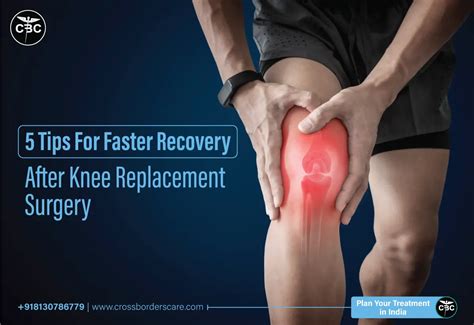 Knee Replacement Recovery 的图像结果