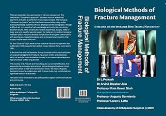 Buy Biological Methods of fracture Management Book Online at Low Prices ...
