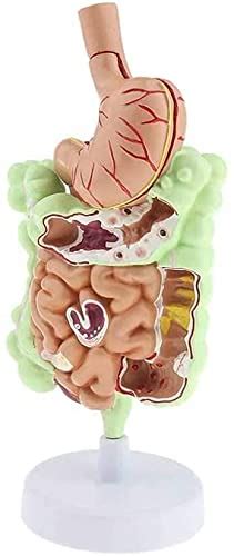Anatomy Model Assembly Anatomy Pathological Model Of Human Colon ...