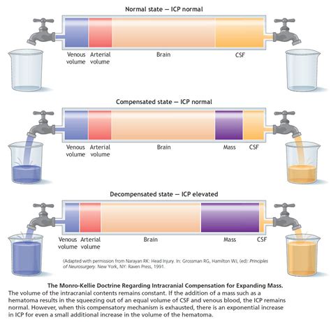 Monro Kellie Doctrine