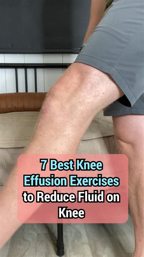 Walking With Knee Effusion at Samantha Fredricksen blog