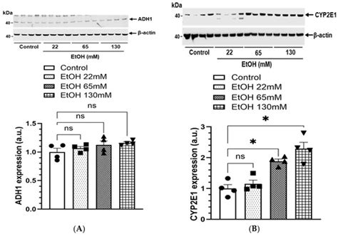 Lipid Metabolic Changes and Mitochondrial Stress in Ethanol-Treated ...