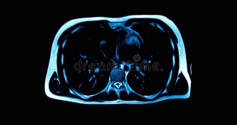 Image result for Body Parts Scan