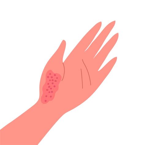 7ページ | 腫れ 画像 - Freepikで無料ダウンロード