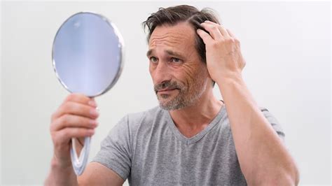 Psychological Damage And Management Of Hair Loss In Men | OnlyMyHealth