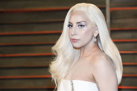 Is Lady Gaga's Unrecognizable Face Due To Surgery?