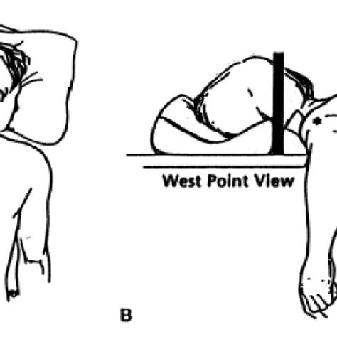 Image result for Normal Shoulder Alignment