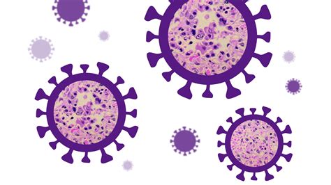 See a map of 16 states with confirmed measles cases