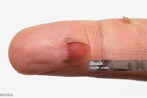 Image result for Finger Under Microscope