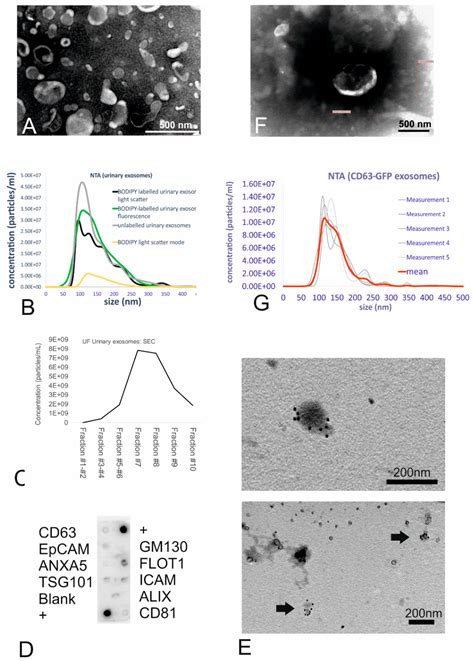 Isolation of Human Small Extracellular Vesicles and Tracking of Their ...