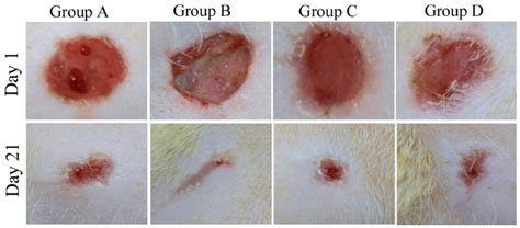 Stages Of Ringworm Healing