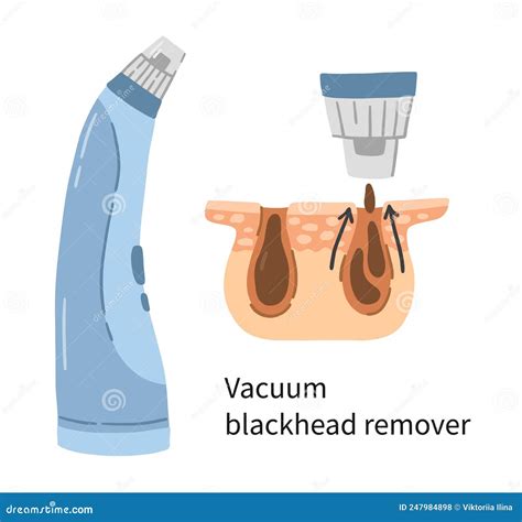 This Blackhead Removal Blew My Mind! (GRAPHIC) - Truth or Fiction