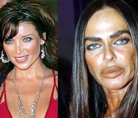 Plastic Surgery Disasters 的图像结果