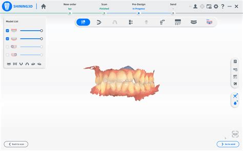 How to upload an order to your cloud : Dental Support