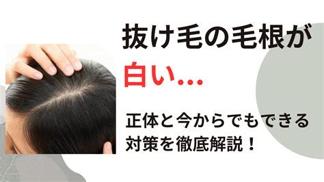 心配しないで！抜け毛の毛根が白い原因と4つの対策方法 - 診療比較ナビ