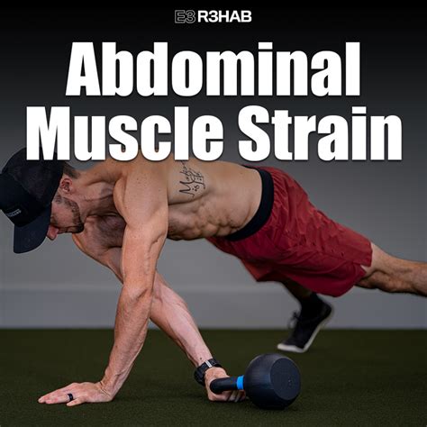 Treatment Abdominal Muscle Strain at Carlos Atwood blog